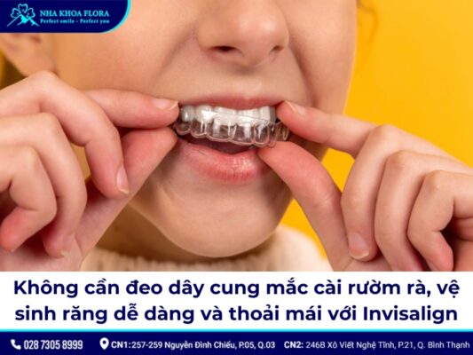 dây cung niềng răng - ảnh 6 dây cung niềng răng - ảnh 6