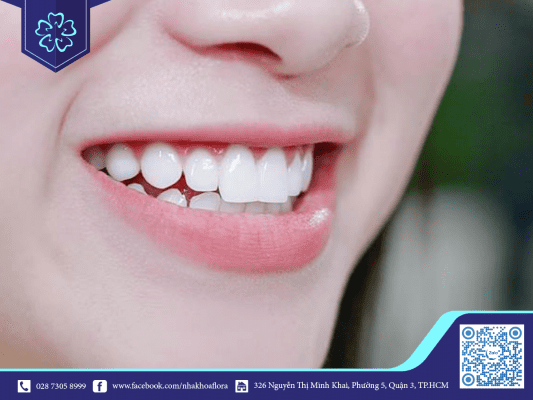 dieu-can-biet-ve-rang-rang-la-duy-nhat What you need to know about teeth: teeth are unique.