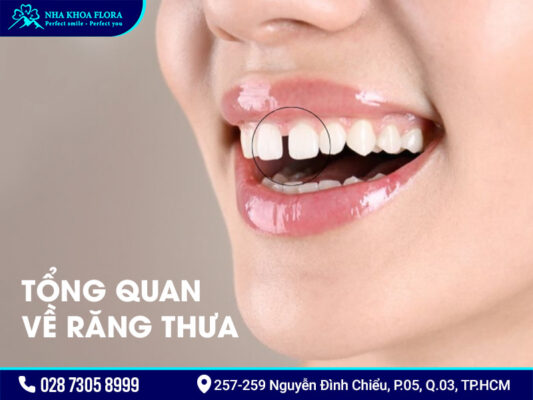 Răng thưa có niềng được không - ảnh 1 Răng thưa có niềng được không - ảnh 1