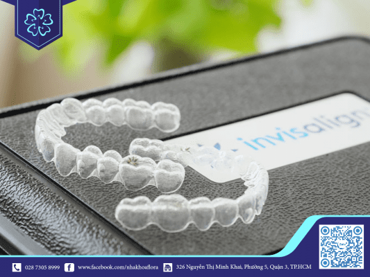 Niềng răng Invisalign được điều chỉnh phù hợp lộ trình