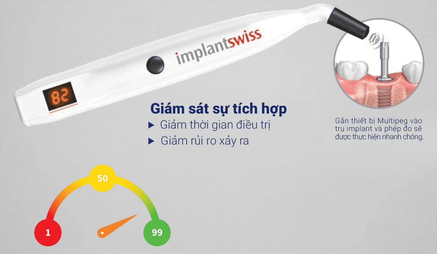 Thiết bị hỗ trợ đánh giá độ ổn định của cấy ghép Implant – PenguinRFA Thiết bị hỗ trợ đánh giá độ ổn định của cấy ghép Implant – PenguinRFA