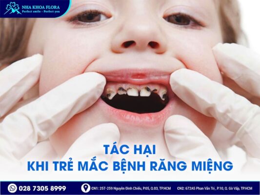 chăm sóc răng miệng cho trẻ - ảnh 2 chăm sóc răng miệng cho trẻ - ảnh 2