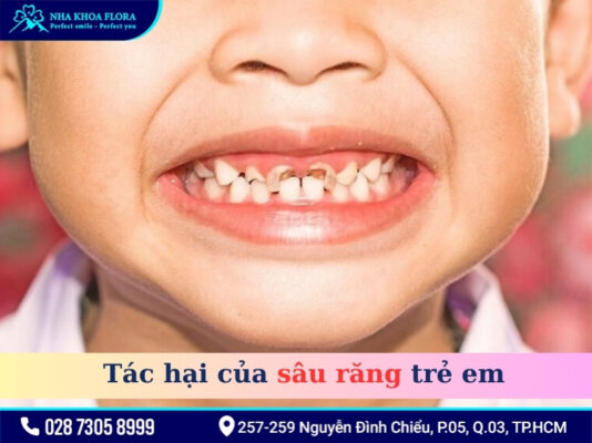 Thói quen xấu gây sâu răng ở trẻ - ảnh 1 Thói quen xấu gây sâu răng ở trẻ - ảnh 1