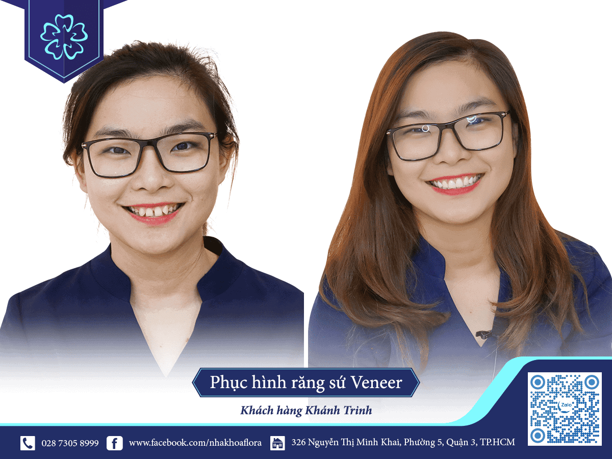 Khách hàng phục hình răng sứ tại Nha Khoa Flora