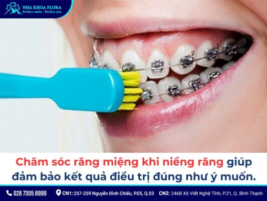 cách chăm sóc răng miệng khi niềng răng - ảnh 1 cách chăm sóc răng miệng khi niềng răng - ảnh 1