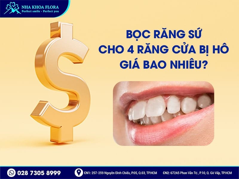 Bọc răng sứ cho 4 răng cửa bị hô - ảnh 4 Bọc răng sứ cho 4 răng cửa bị hô - ảnh 4