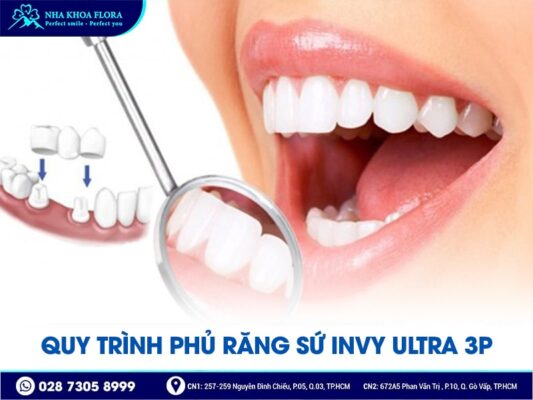 Công nghệ phủ răng sứ Invy Ultra 3P - ảnh 4 Công nghệ phủ răng sứ Invy Ultra 3P - ảnh 4