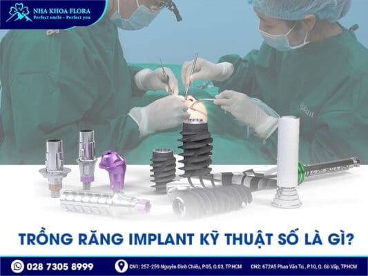 trồng răng implant kỹ thuật số - ảnh 1 trồng răng implant kỹ thuật số - ảnh 1