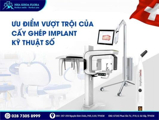 trồng răng implant kỹ thuật số - ảnh 2 trồng răng implant kỹ thuật số - ảnh 2