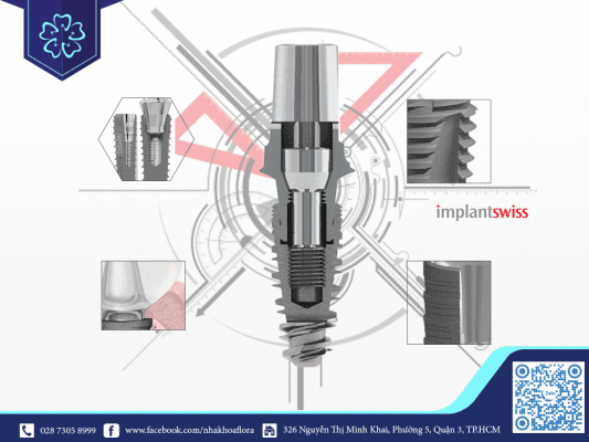 Độ chính xác của trụ Implant Thuỵ Sĩ Không nên cấy ghép implant giá rẻ