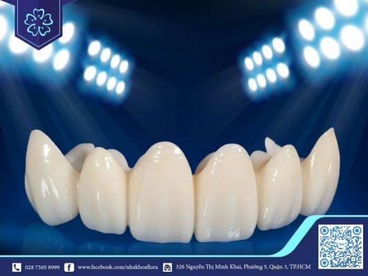 Cercon porcelain teeth