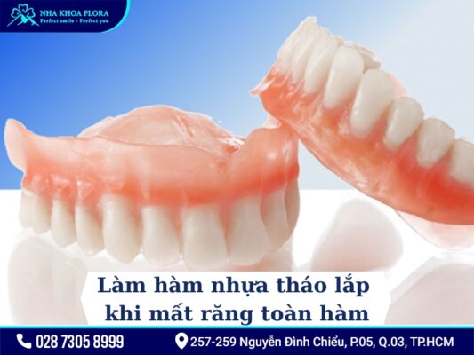 Phương pháp điều trị mất răng - ảnh 5 Phương pháp điều trị mất răng - ảnh 5