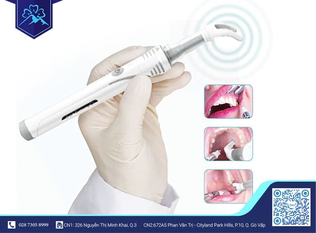 Thiết bị Dental Vibe