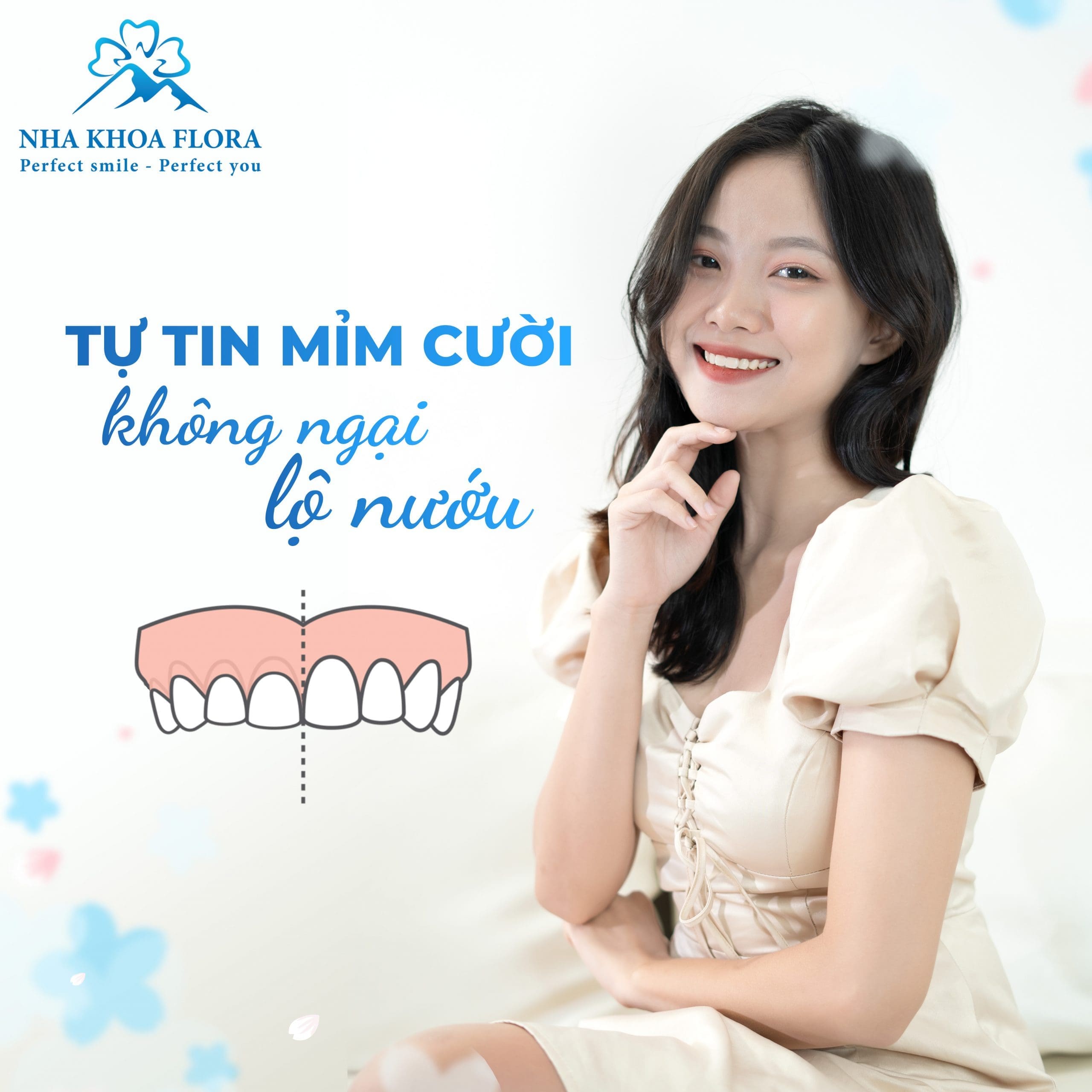 Loại bỏ nỗi lo "cười hở lợi là khổ" cùng Nha Khoa Flora Loại bỏ nỗi lo "cười hở lợi là khổ" cùng Nha Khoa Flora