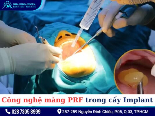 Công nghệ màng PRF - ảnh 2 Công nghệ màng PRF - ảnh 2