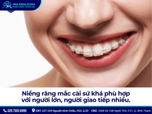 niềng răng mắc cài - ảnh 7 niềng răng mắc cài - ảnh 7