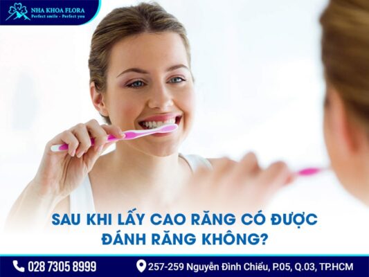 Lưu ý sau khi lấy cao răng - ảnh 4 Lưu ý sau khi lấy cao răng - ảnh 4