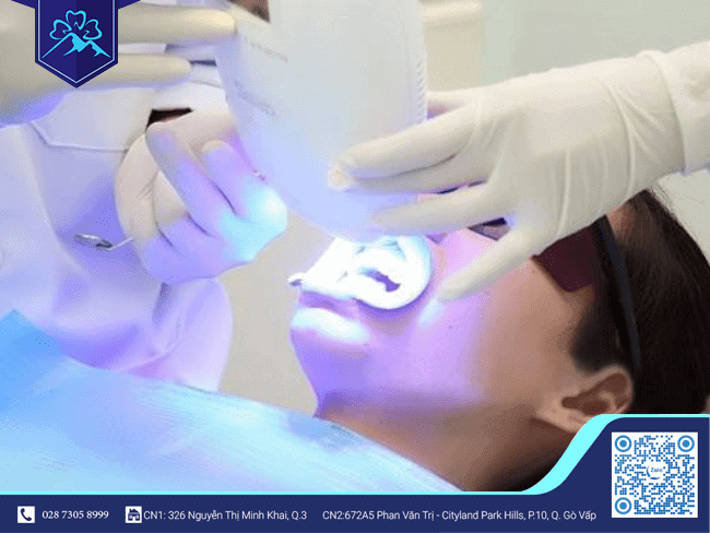 Khái niệm phương pháp tẩy trắng răng với công nghệ Plasma Khái niệm phương pháp tẩy trắng răng với công nghệ Plasma