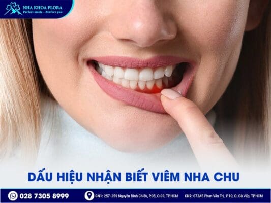 Viêm nha chu - ảnh 2 Viêm nha chu - ảnh 2
