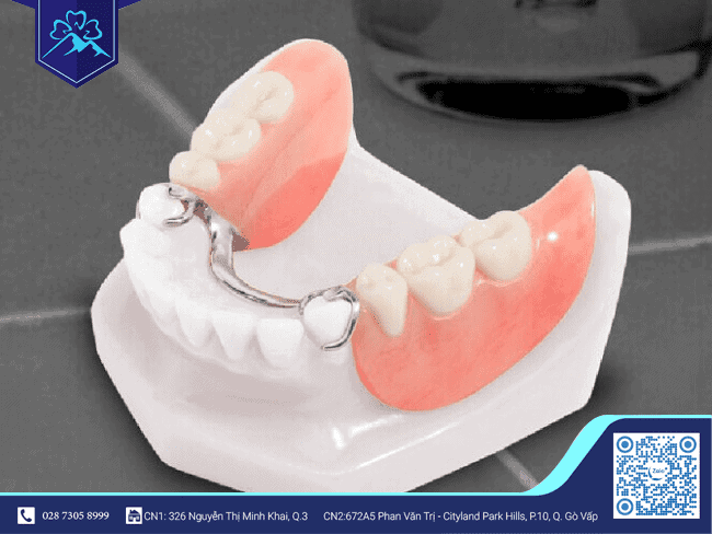 Răng tạm tháo lắp Răng tạm tháo lắp