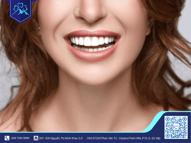 Khớp cắn lệch có nguy cơ tác động xấu đến Implant Khớp cắn lệch có nguy cơ tác động xấu đến Implant