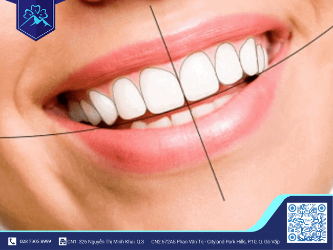 Khớp cắn chuẩn là như thế nào? Khớp cắn chuẩn là như thế nào?