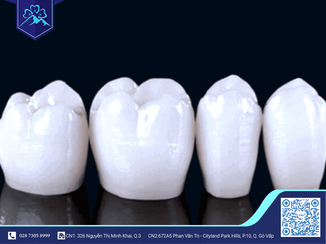 Lưu ý khi sử dụng răng tạm Lưu ý khi sử dụng răng tạm