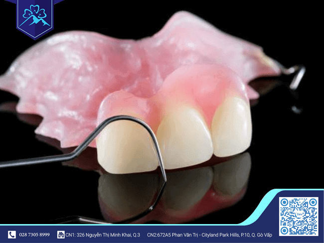 Răng tạm có thể tháo lắp Răng tạm có thể tháo lắp