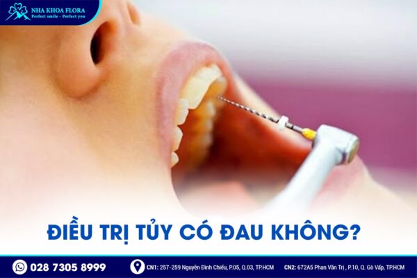 điều trị tủy có đau không - ảnh 2 điều trị tủy có đau không - ảnh 2