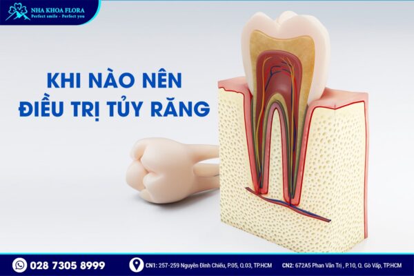 điều trị tủy có đau không - ảnh 3 điều trị tủy có đau không - ảnh 3