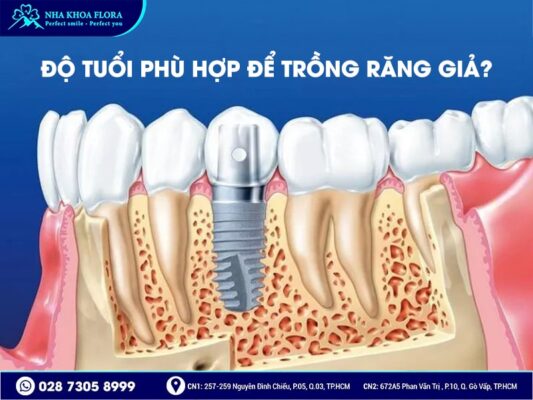 bao nhiêu tuổi mới trồng răng được - ảnh 1 bao nhiêu tuổi mới trồng răng được - ảnh 1