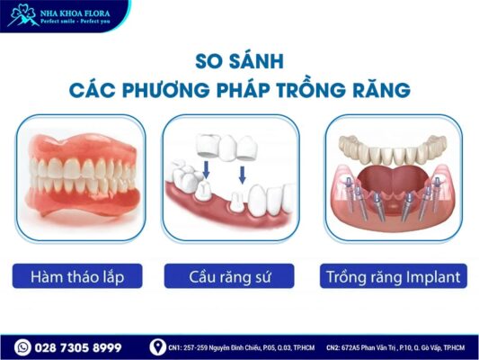 bao nhiêu tuổi mới trồng răng được - ảnh 2 bao nhiêu tuổi mới trồng răng được - ảnh 2