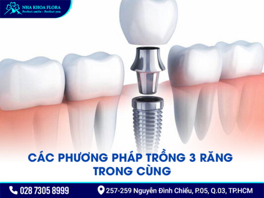 Gãy 3 răng trong cùng - ảnh 1 Gãy 3 răng trong cùng - ảnh 1