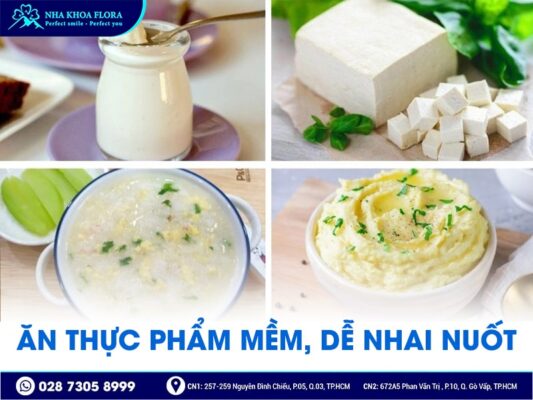 lưu ý khi niềng răng - ảnh 2 lưu ý khi niềng răng - ảnh 2