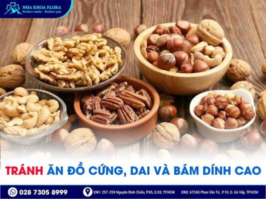 lưu ý khi niềng răng - ảnh 3 lưu ý khi niềng răng - ảnh 3