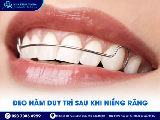 lưu ý khi niềng răng - ảnh 4 lưu ý khi niềng răng - ảnh 4