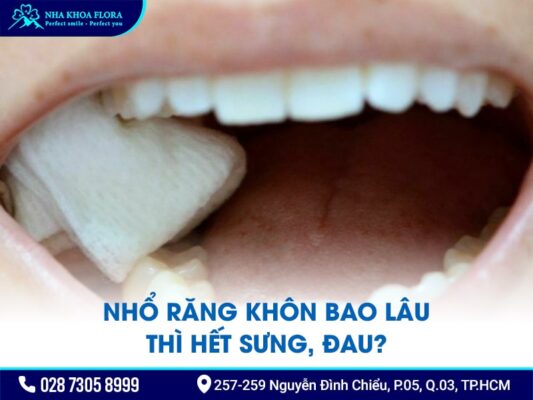 nhổ răng khôn bao lâu thì lành - ảnh 2 nhổ răng khôn bao lâu thì lành - ảnh 2