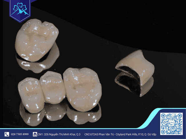 Cấu tạo của răng sứ Cấu tạo của răng sứ