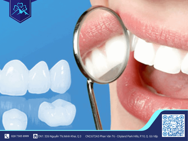 Lưu ý khi bọc răng sứ - Bọc răng sứ cần kiêng hoạt động nào?? Lưu ý khi bọc răng sứ - Bọc răng sứ cần kiêng hoạt động nào??