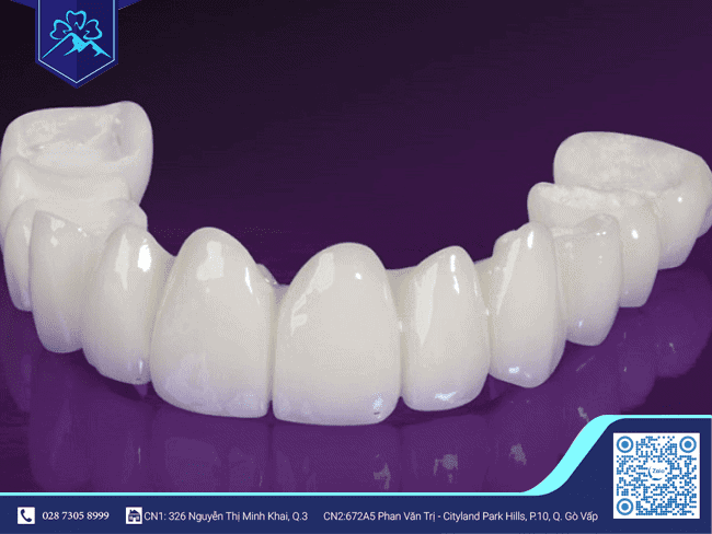 Răng sứ Lava Plus Răng sứ Lava Plus