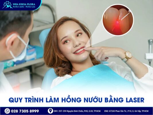 làm hồng nướu bằng Laser - ảnh 3 làm hồng nướu bằng Laser - ảnh 3