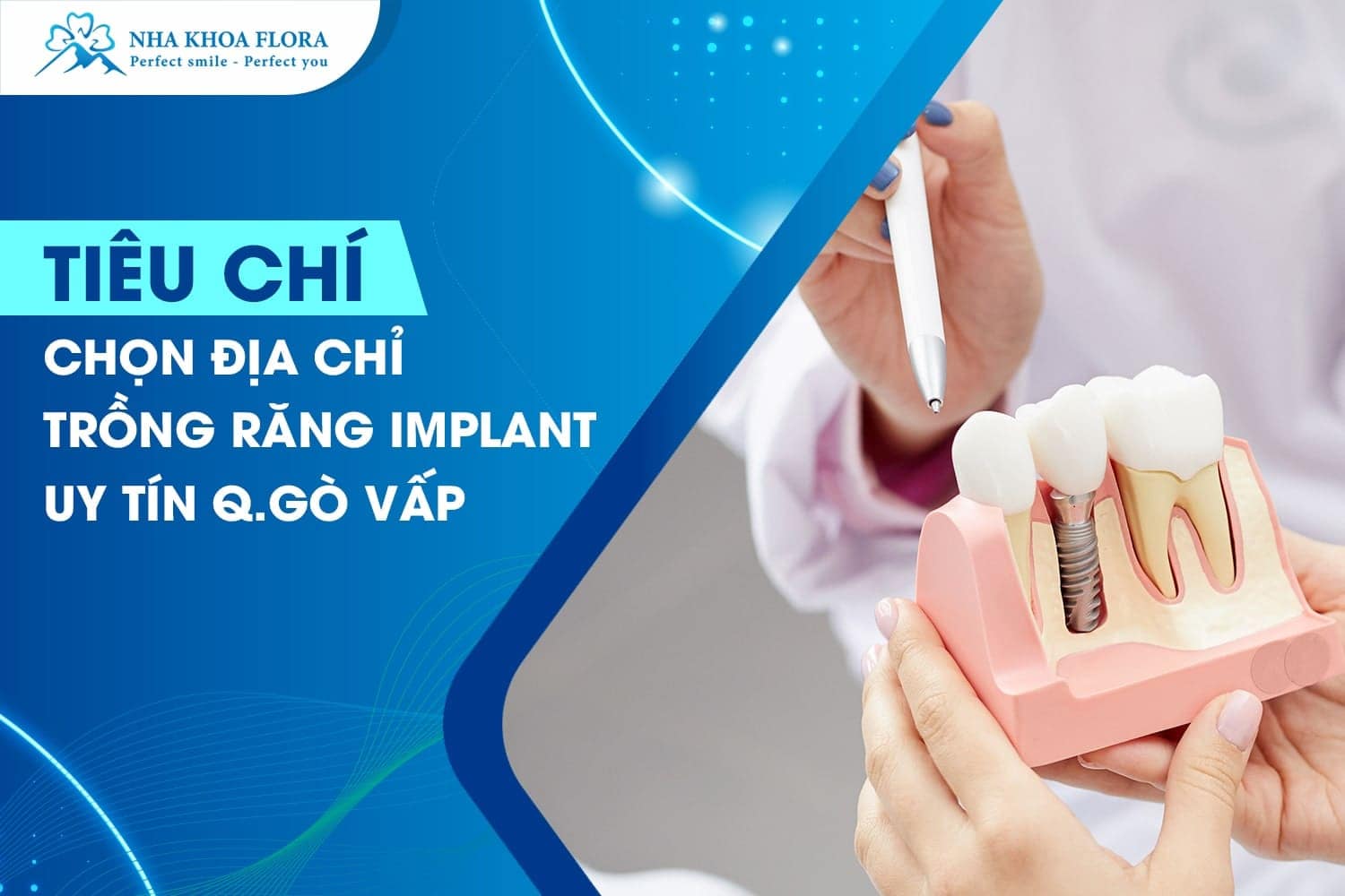 Top 3 Địa Chỉ Trồng Răng Implant Uy Tín Quận Gò Vấp - ảnh 1 Top 3 Địa Chỉ Trồng Răng Implant Uy Tín Quận Gò Vấp - ảnh 1