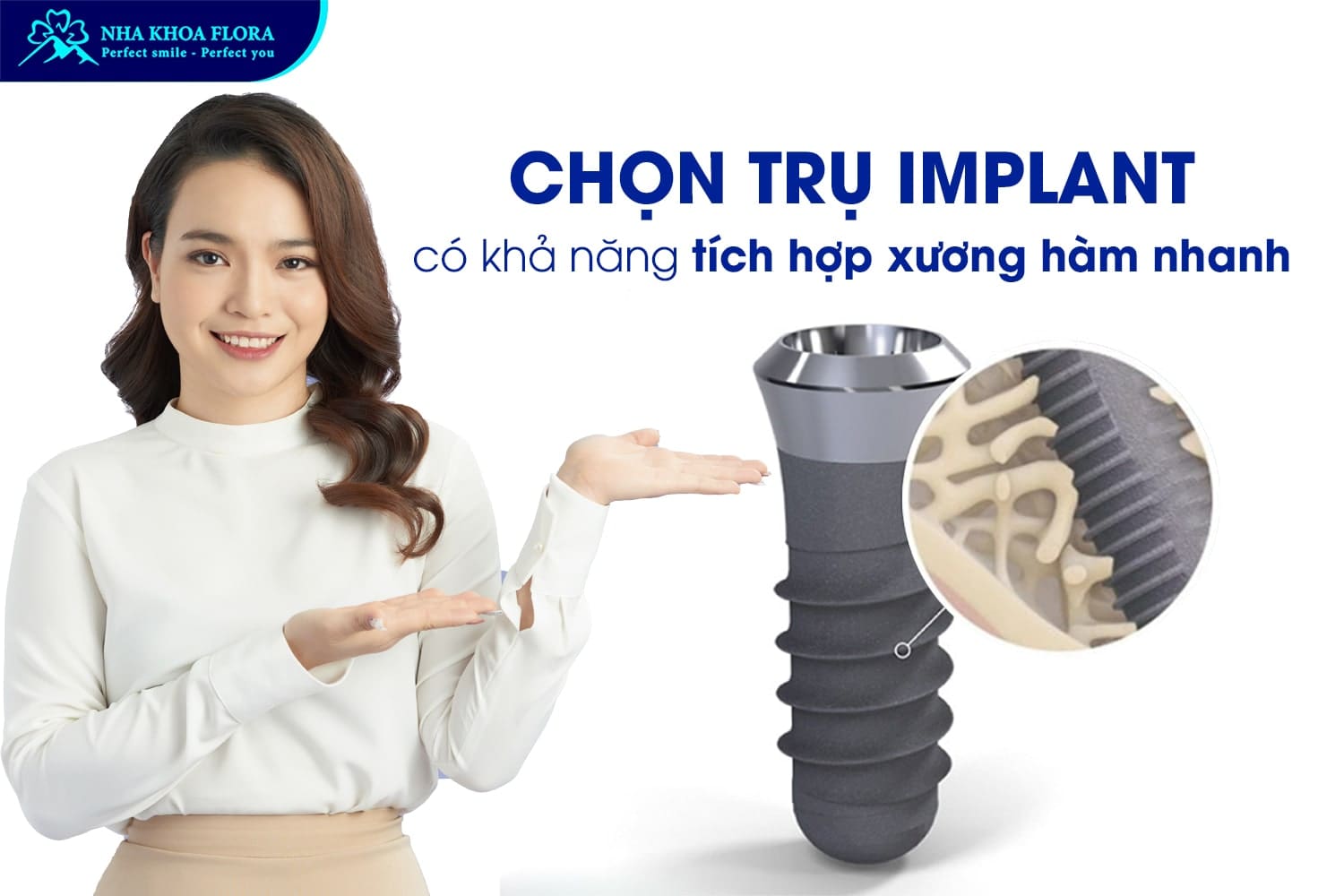 Hỏi Đáp: Trồng Răng Implant Bao Lâu Thì Lành? - ảnh 4 Hỏi Đáp: Trồng Răng Implant Bao Lâu Thì Lành? - ảnh 4