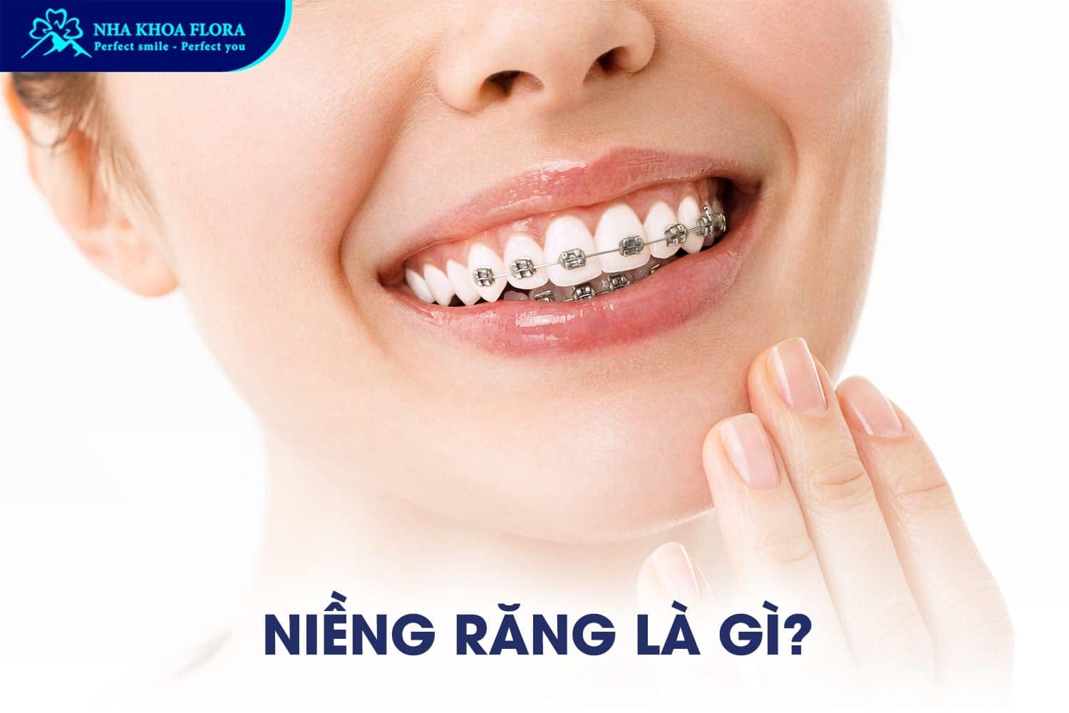 Trồng Răng Implant Có Niềng Răng Được Không? - ảnh 2 Trồng Răng Implant Có Niềng Răng Được Không? - ảnh 2