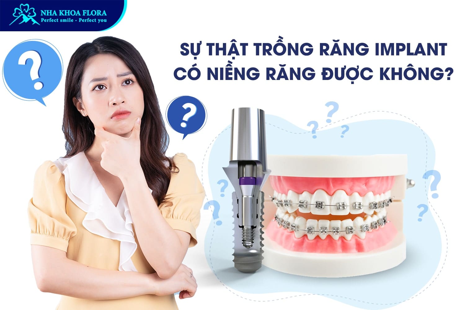 Trồng Răng Implant Có Niềng Răng Được Không? - ảnh 3 Trồng Răng Implant Có Niềng Răng Được Không? - ảnh 3