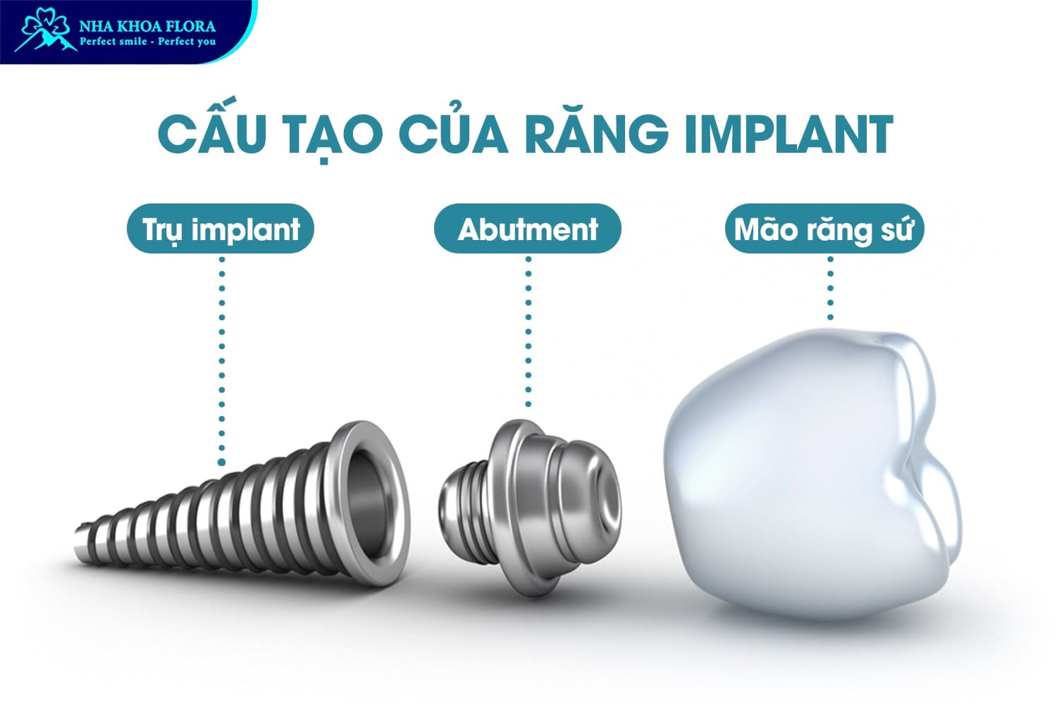 Trồng Răng Implant Là Gì? 10 Điều Cần Biết Trước Khi Thực Hiện - ảnh 2 Trồng Răng Implant Là Gì? 10 Điều Cần Biết Trước Khi Thực Hiện - ảnh 2