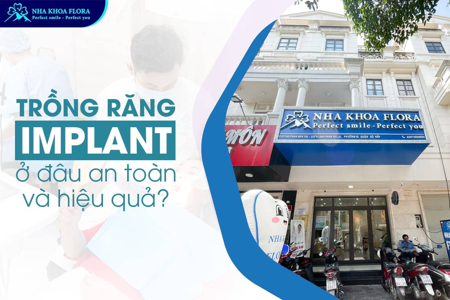 Trồng Răng Implant Là Gì? 10 Điều Cần Biết Trước Khi Thực Hiện - ảnh 5 Trồng Răng Implant Là Gì? 10 Điều Cần Biết Trước Khi Thực Hiện - ảnh 5