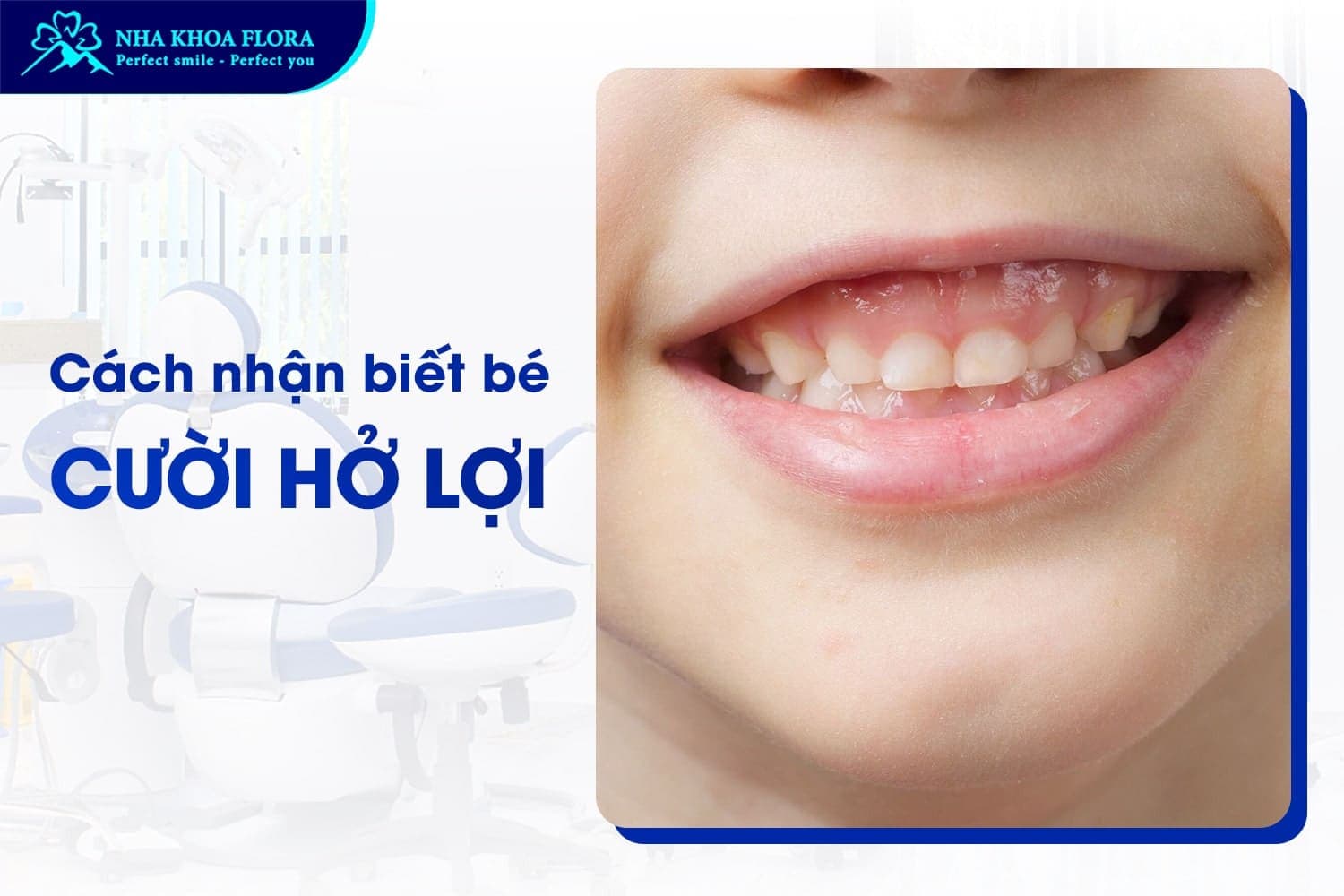 Bé Cười Hở Lợi Có Sao Không? Có Nên Khắc Phục Sớm? - ảnh 1 Bé Cười Hở Lợi Có Sao Không? Có Nên Khắc Phục Sớm? - ảnh 1