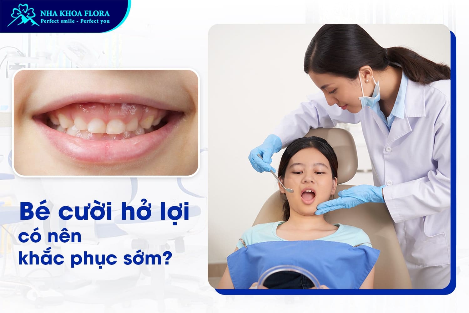 Bé Cười Hở Lợi Có Sao Không? Có Nên Khắc Phục Sớm? - ảnh 3 Bé Cười Hở Lợi Có Sao Không? Có Nên Khắc Phục Sớm? - ảnh 3