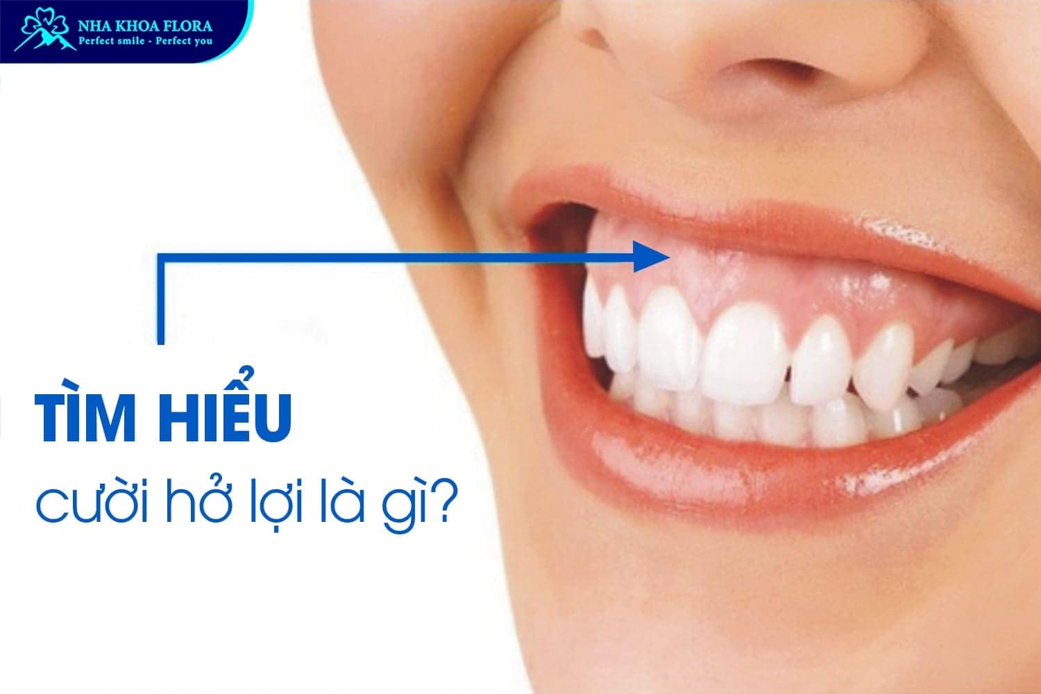 Bỏ Túi 8 Cách Cười Không Hở Lợi Đơn Giản Nhất - ảnh 1 Bỏ Túi 8 Cách Cười Không Hở Lợi Đơn Giản Nhất - ảnh 1